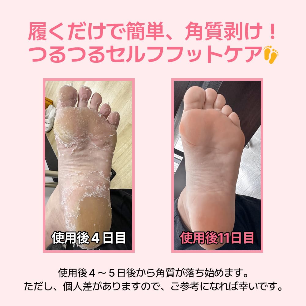 MADFORCOS Exfoliating Foot Peel Mask with AHA/BHA & 4 Fruit Extracts – Removes Dead Skin & Calluses for Baby Soft Feet – Foot Peeling Mask Socks for Dry, Cracked Feet (4 Pairs)