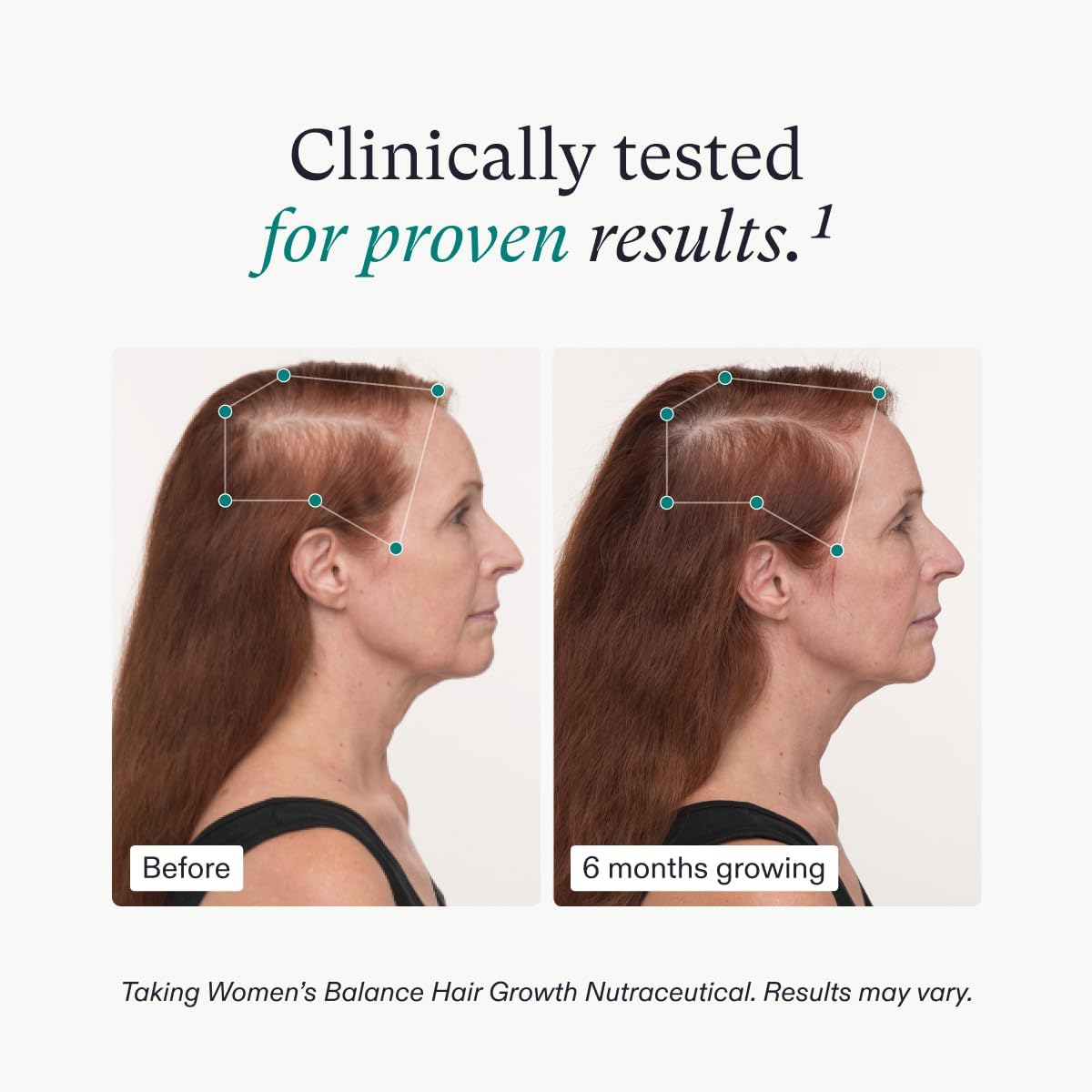 Nutrafol Women's Balance Hair Growth Supplement and Hair Serum, Ages 45 and Up, for Visible Thickness and Strength - 3 Month Supply, 1.7 Fl Oz Bottle
