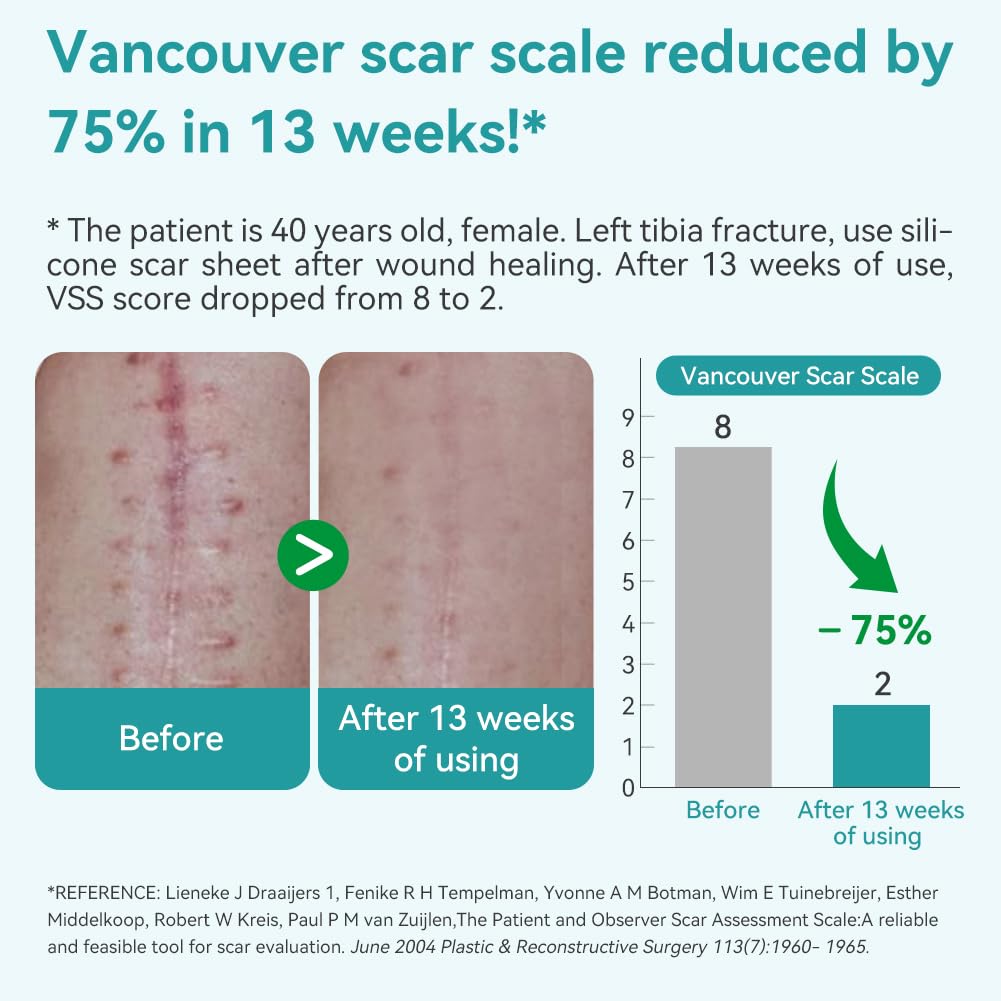Dimora 2 Packs 6oz Hydrogel First Aid Ointment & Waterproof Silicone Scar Sheets