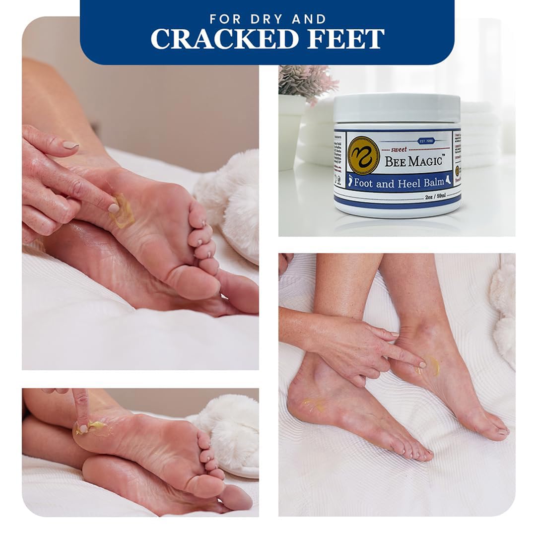 Sweet Bee Naturals Organic Foot Balm - Intensive Heel Balm for Dry Cracked Feet - Natural Moisturizing Treatment for Cracked Heels - Heel Cream Softener for Rough Skin Repair 1 Jar (2 OZ)