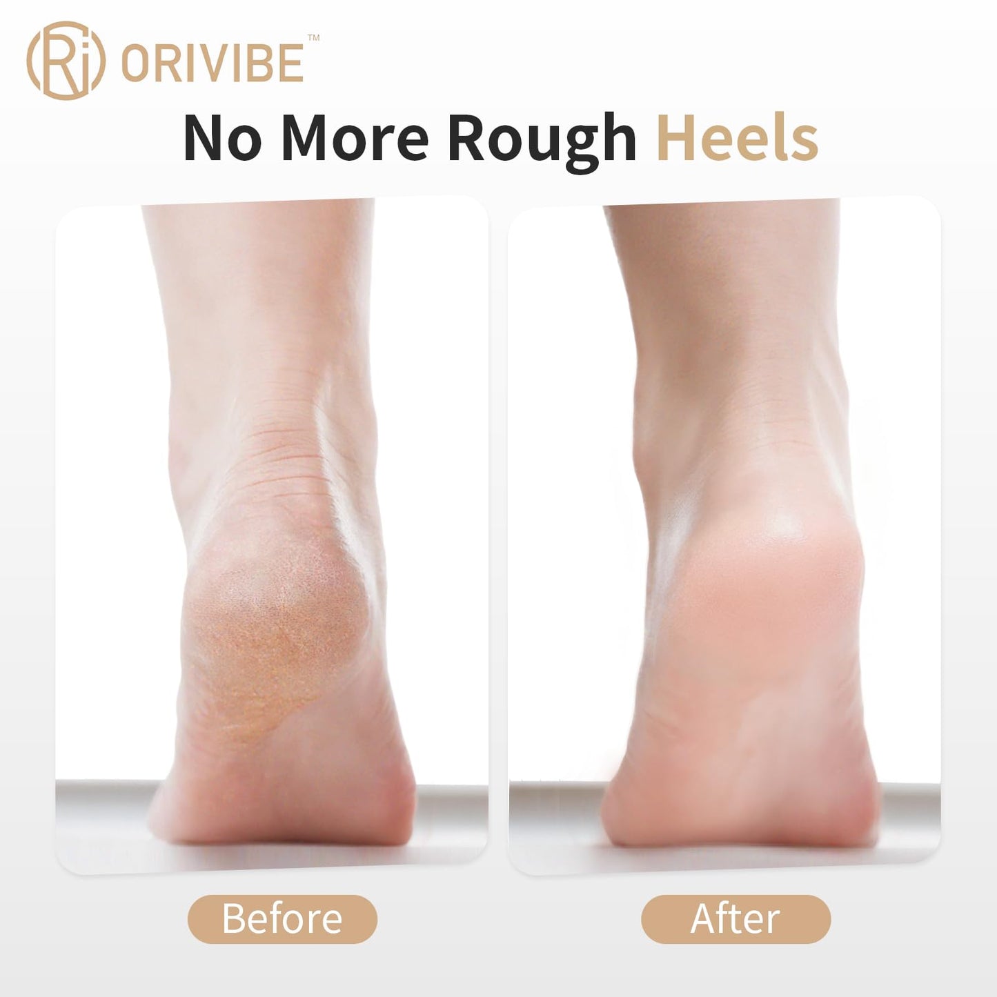 Orivibe Electric Foot Callus Remover for Feet - Rechargeable Pedicure Tools, 2-Speed Electric Foot File with Washable Rollers, Instant Dead Skin Remover & Foot Care Gift for Women and Men