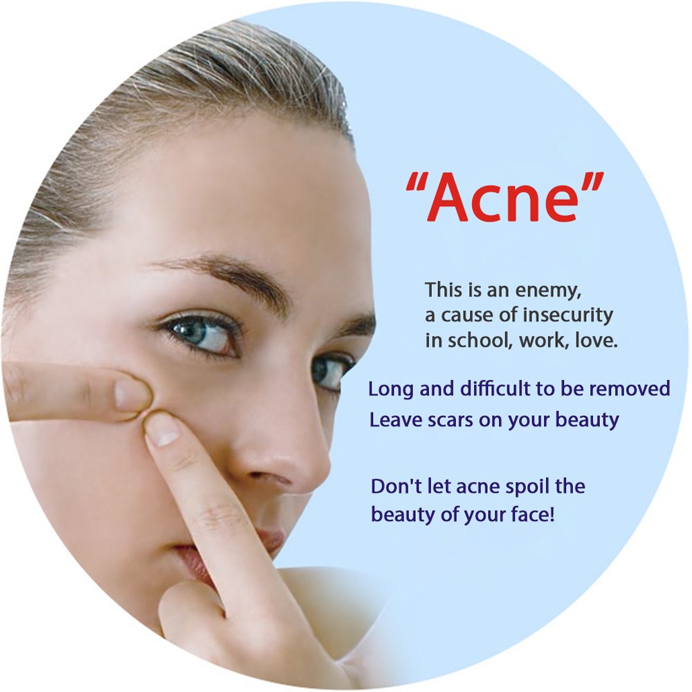 (0BQY0733) Acne Removal Rejuvenation Moisturizing Mask