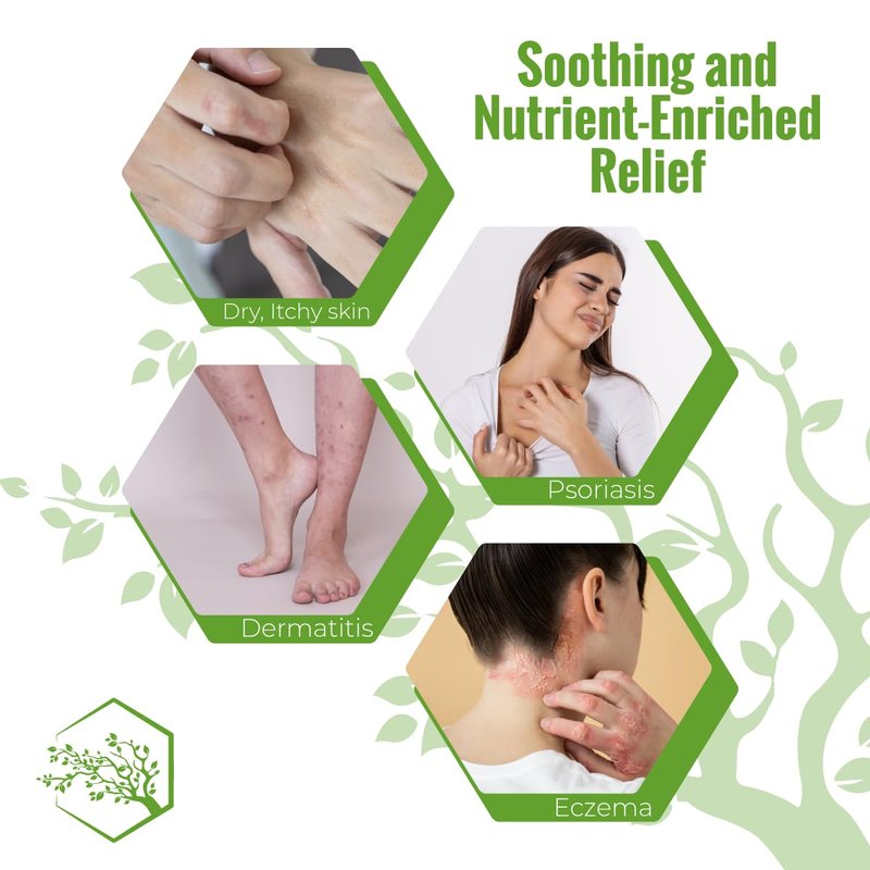 Wild Naturals Moisturizing Eczema Body Wash, Gentle Psoriasis Body Wash for Itchy, Dry Skin Relief Eczema Soap for Redness and Flareups, Hydrating Cleanser for Women and Men