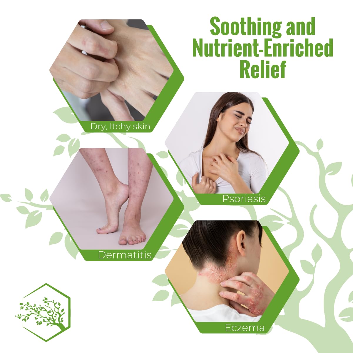 Wild Naturals Moisturizing Eczema Body Wash, Gentle Psoriasis Body Wash for Itchy, Dry Skin Relief Eczema Soap for Redness and Flareups, Hydrating Cleanser for Women and Men