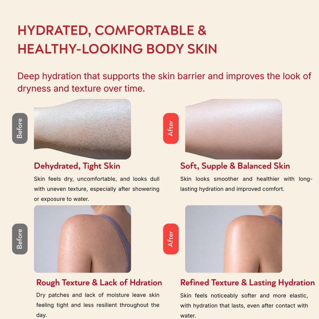 ABI AME Summer Skin Body Serum - Niacinamide Body Serum with Saccharide Isomerate - Hydrating Lightweight Body Lotion for Dry Skin - Fast Absorbing, Non-Greasy Made in France - 150ml