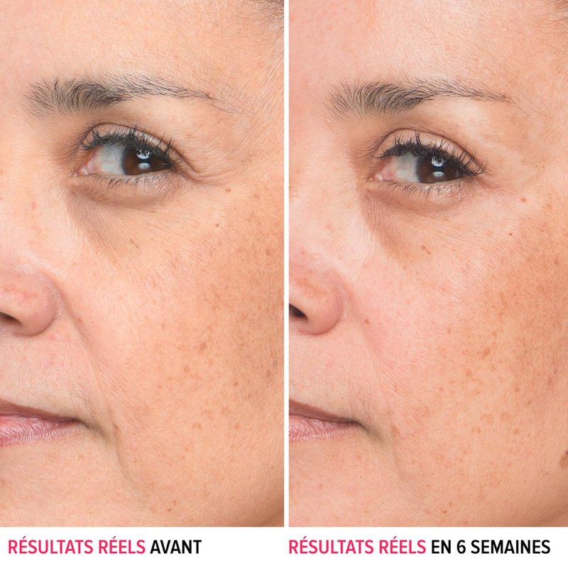IT Cosmetics Bye Bye Lines Hyaluronic Acid Serum for Face - Hydrating Anti-Aging Facial Serum With Peptide & Vitamin B5, Visibly Plumps Skin, Smooths Look of Fine Lines, For All Skin Types - 1 fl oz