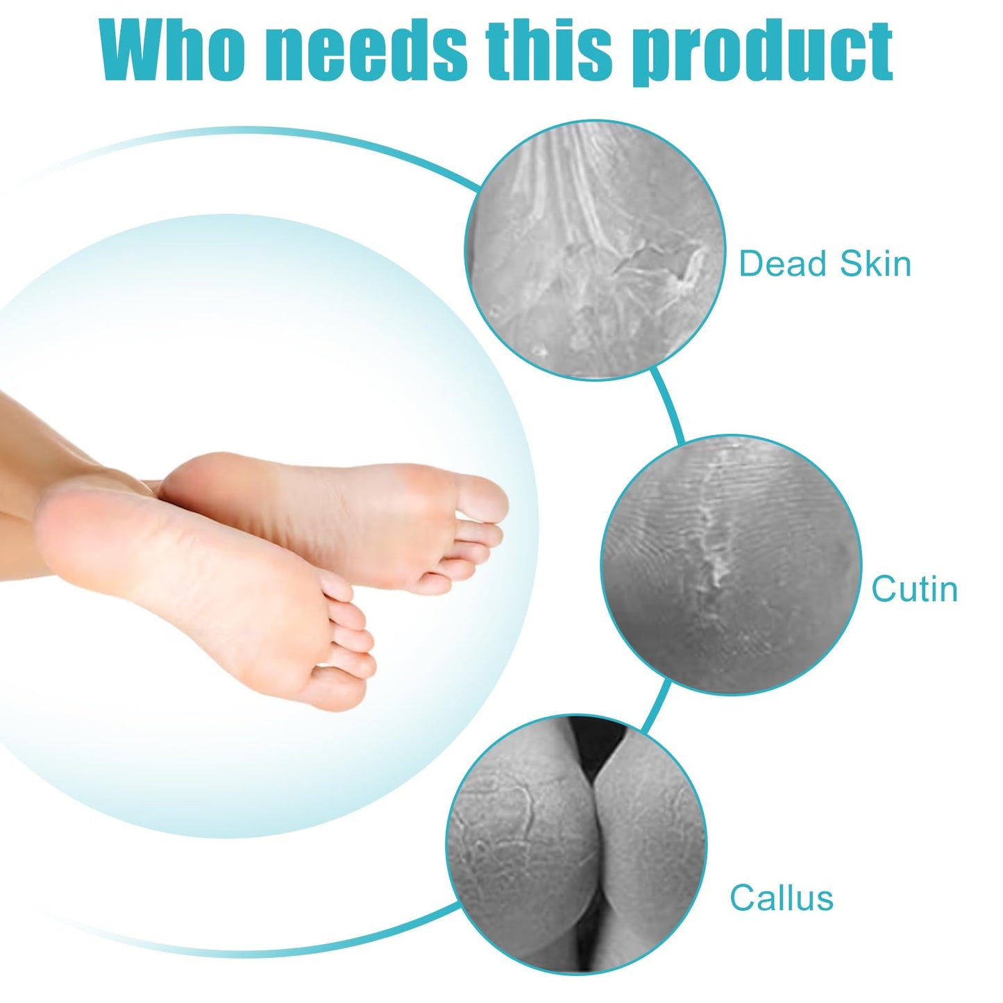 Yclin Foot File Callus Remover-3 Pcs 4 in 1 Foot Scrubber Dead Skin Remover for Feet,Pumice Stone, Foot Rasp and Sand Paper for Home Foot Care,Foot Brush for Shower (Grey Pedicure Foot File)