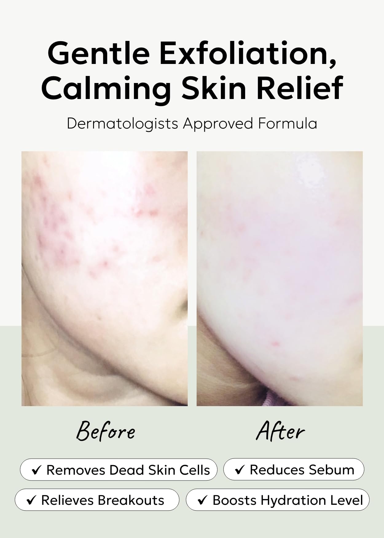 celimax Ji.Woo.Gae Heartleaf BHA Peeling Pad(60 pads) + Noni Energy Ampoule 30ml Bundle