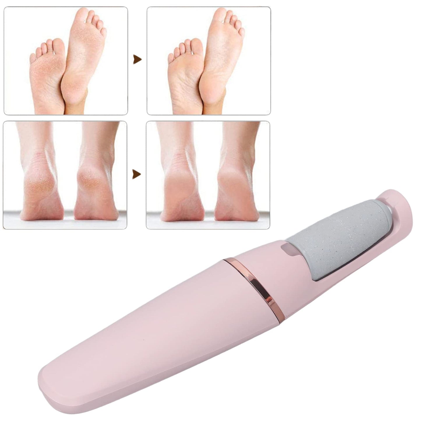 Electric Foot Grinder Callus Remover File for Feet 2 Levels Speed Setting Ergonomic Design USB Charging Grinder