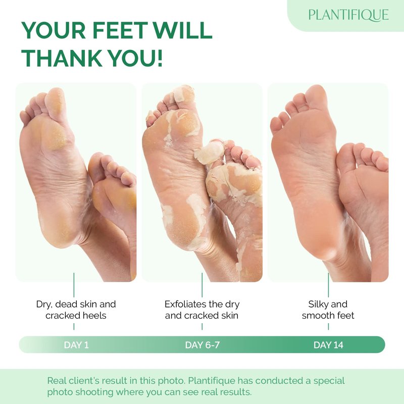 PLANTIFIQUE Foot Peeling Mask 4 Pack | Dermatologically Tested Repairs Heels & Removes Dry Dead Skin for Baby Soft Feet | Exfoliating Foot Peel Mask for Dry Cracked Feet | Peach