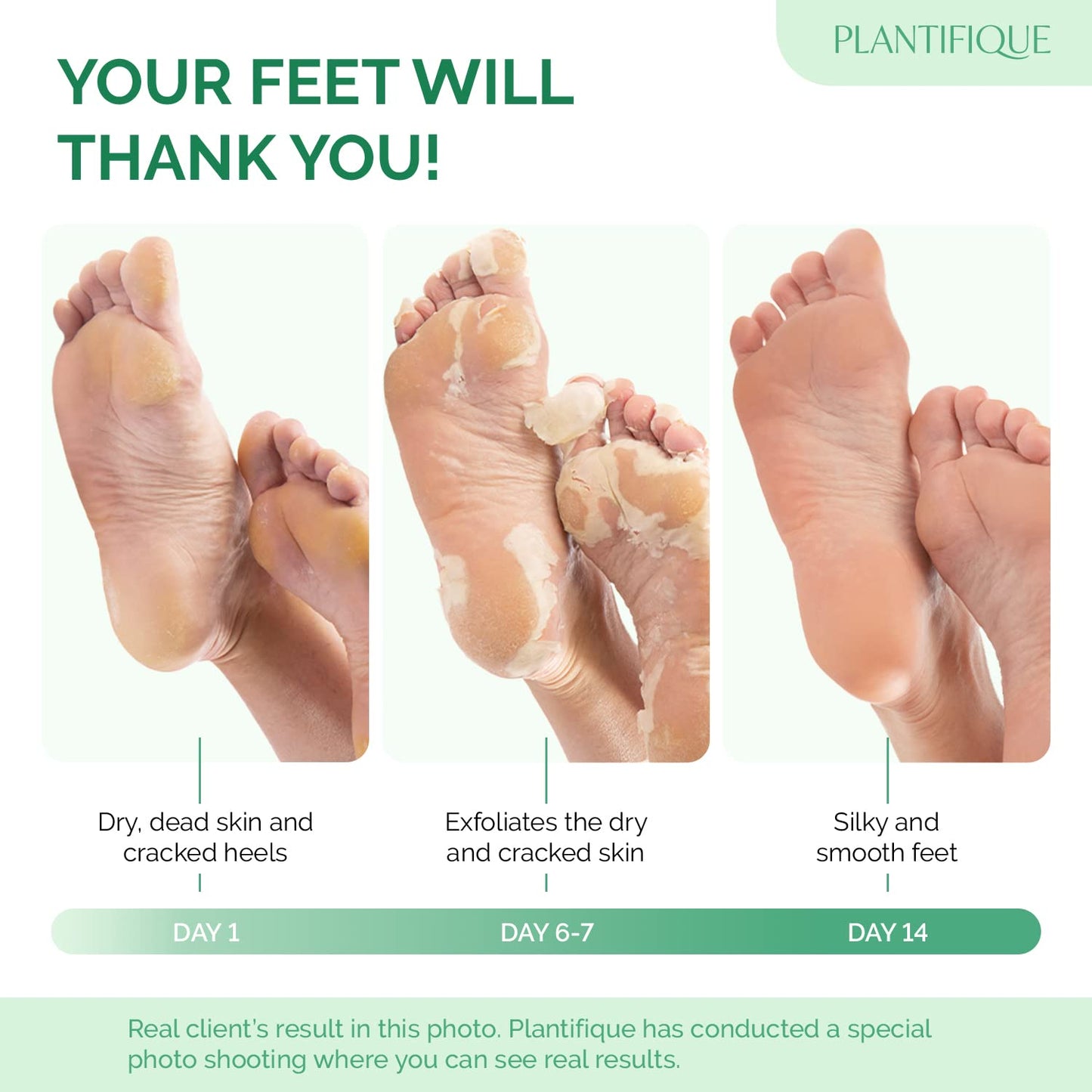 PLANTIFIQUE Foot Peel Mask with Peach 2 Pack and Hydrating Foot Mask for Dry & Cracked Feet