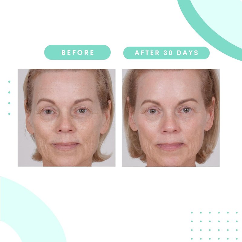 Serious Skincare Glycolic Cleanser - Daily Exfoliating Face Wash with 10% Glycolic Acid | Deep Pore Purifying, 4 Fl. Oz.