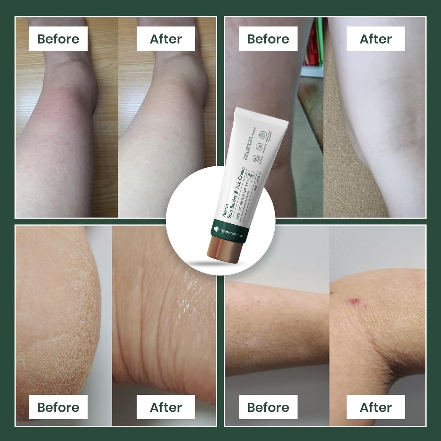 AGERIN Anti-Itch Cream – Skin Barrier and Itch Relief Cream for Sensitive and Dry Skin, Trouble Care, Calming, Hydrating, Purifying, Cruelty Free, Vegan