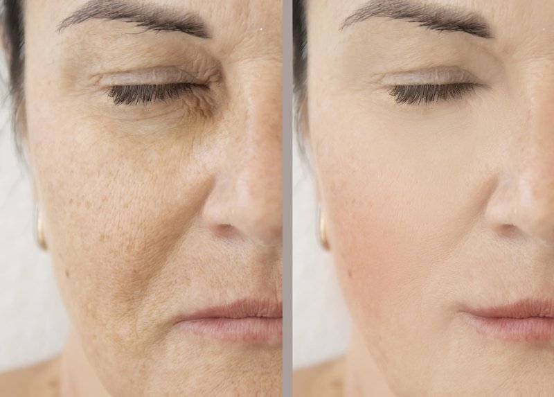 Vitality Precision Skin Phloretin C Serum