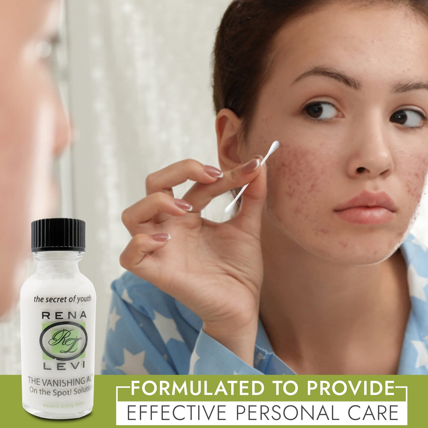 Rena Levi Acne Spot Pimple Drying Lotion - For Face and Body Use, Dries Out Blemishes and Pores - 1oz