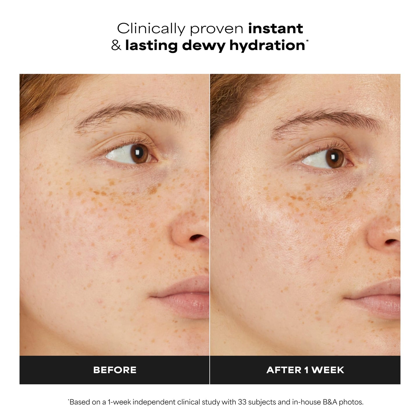 Paula's Choice 7% Ectoin + Hyaluronic Acid Milky Hydrating Face Serum, 7-in-1 Barrier Repair, Deep Hydration, Dewy Finish, Dermatologist-Tested for Sensitive Skin, 0.67 Fl Oz