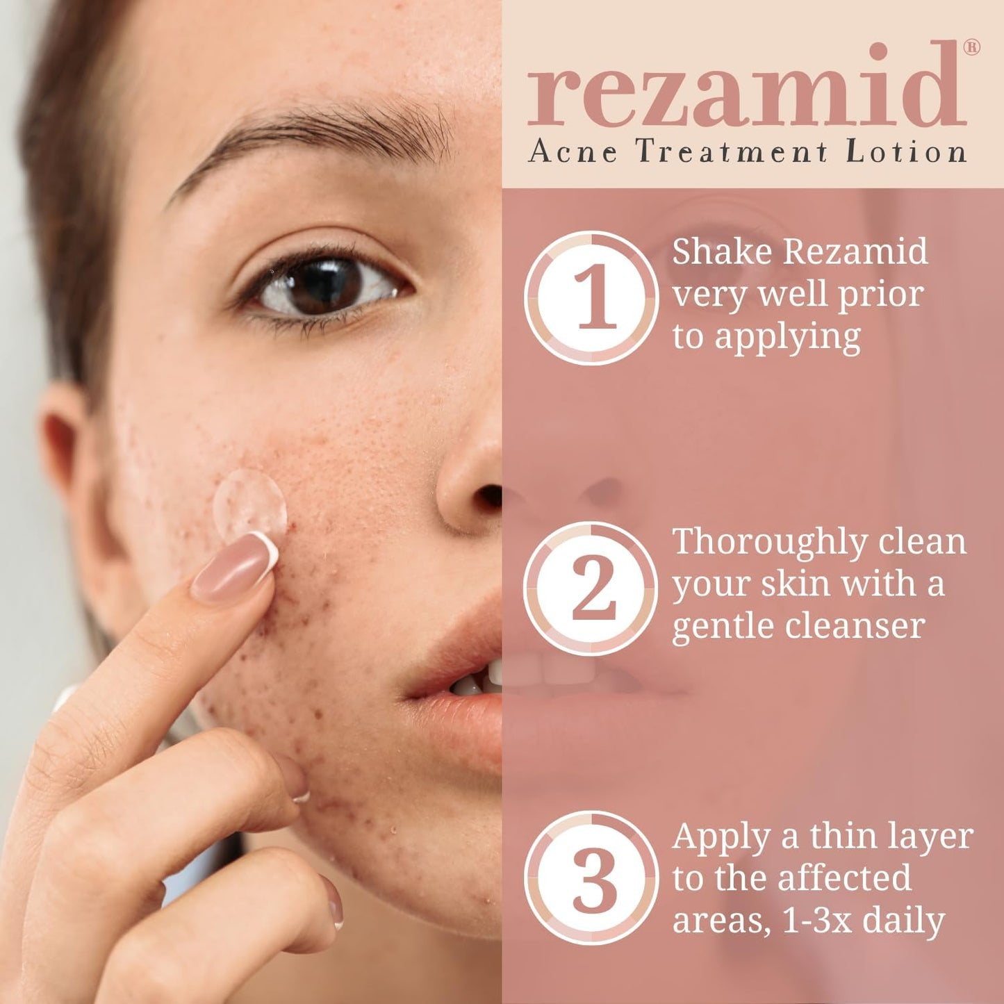 Rezamid Acne Spot Treatment Lotion For Pimples - Skin Clearing Blemish Concealer For Oily Skin With 5% Sulfur & 2% Resorcinol - Sensitive Skin Makeup - Skin Tone Matching Foundation - 2oz