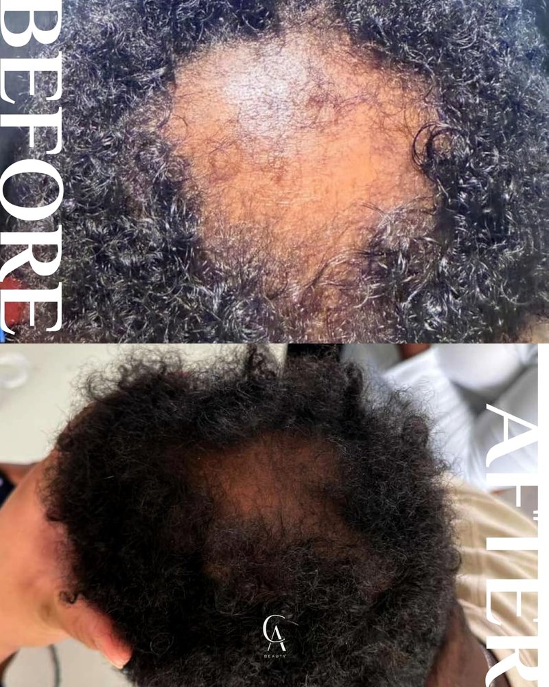 Hair Growth Oil with Rosemary & Peppermint - All-Natural Formula for Thicker Hair | 2oz