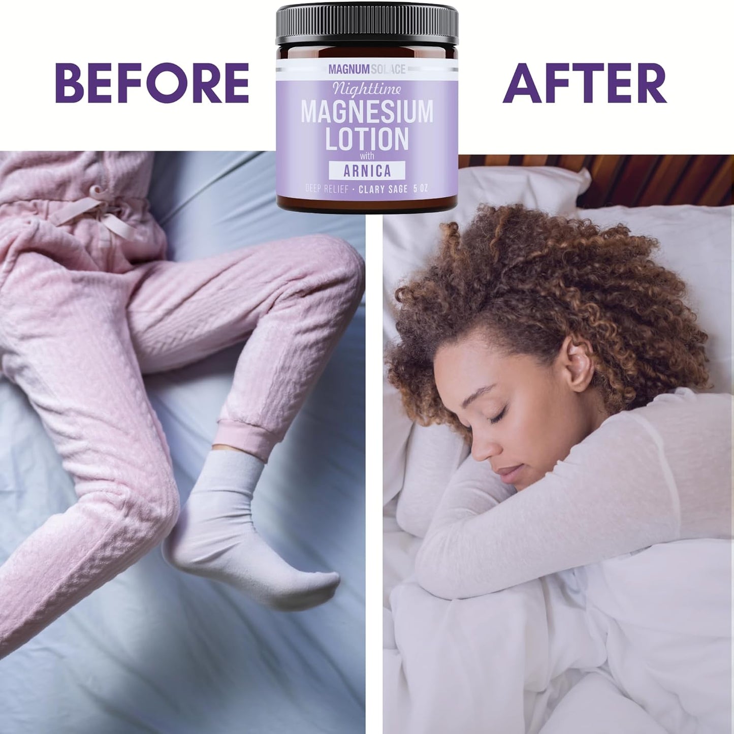 Magnum Solace Magnesium Lotion for Nighttime Relief - Soothing Arnica Formula for Muscles & Joints | Skin-Friendly Application