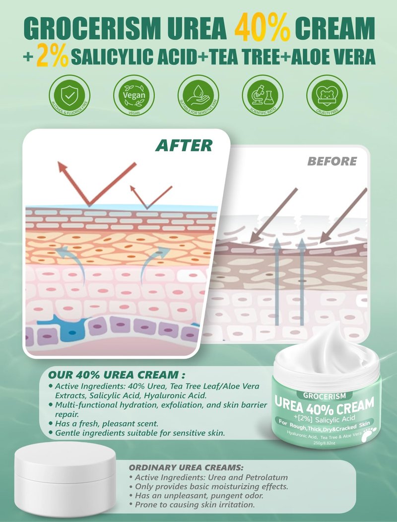 Grocerism Urea Cream 40 Percent For Feet Plus 2% Salicylic Acid 5.29 oz || Foot Cream and Hand Cream Maximum Strength with Hyaluronic Acid,Tea Tree,and Aloe Vera For Deep Moisturizes,Callus Remover