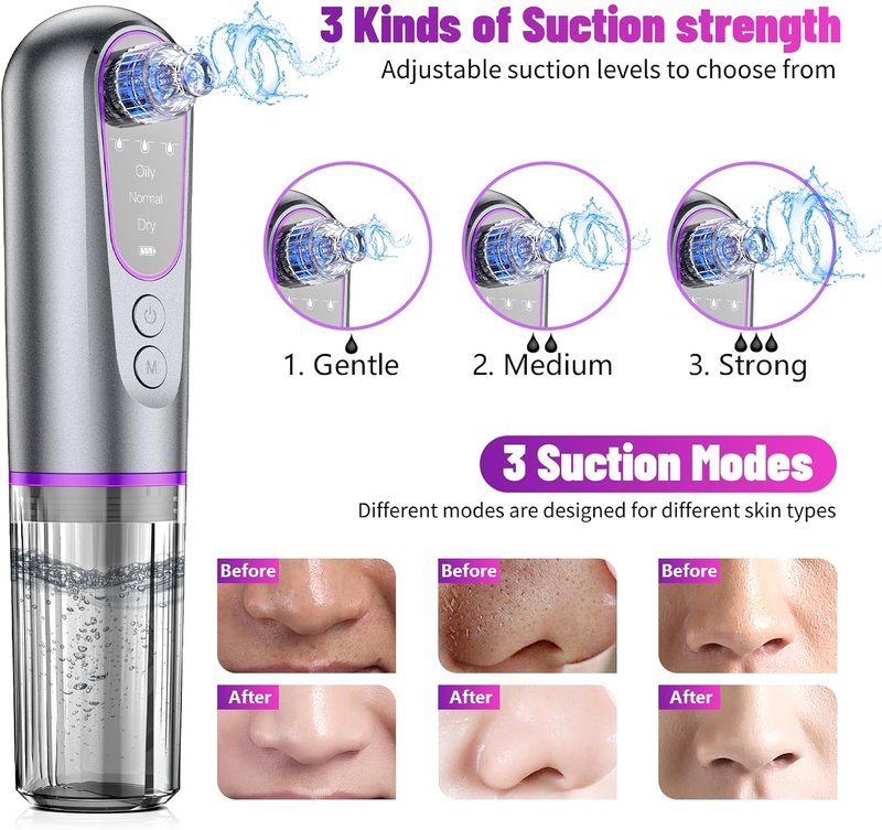 Blackhead Remover Vacuum - Hydrating Pore Cleaner & Pimple Extractor | USB Rechargeable Beauty Device