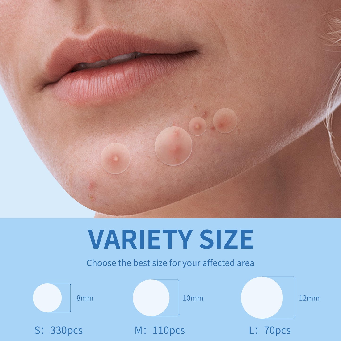 Daolyo Pimple Patches for Face - 3 Size 510 Counts Hydrocolloid Acne Patches for Covering Zits and Blemishes, Spot Stickers with Salicylic Acid, Tea Tree Oil & Calendula Oil(8mm,10mm,12mm)