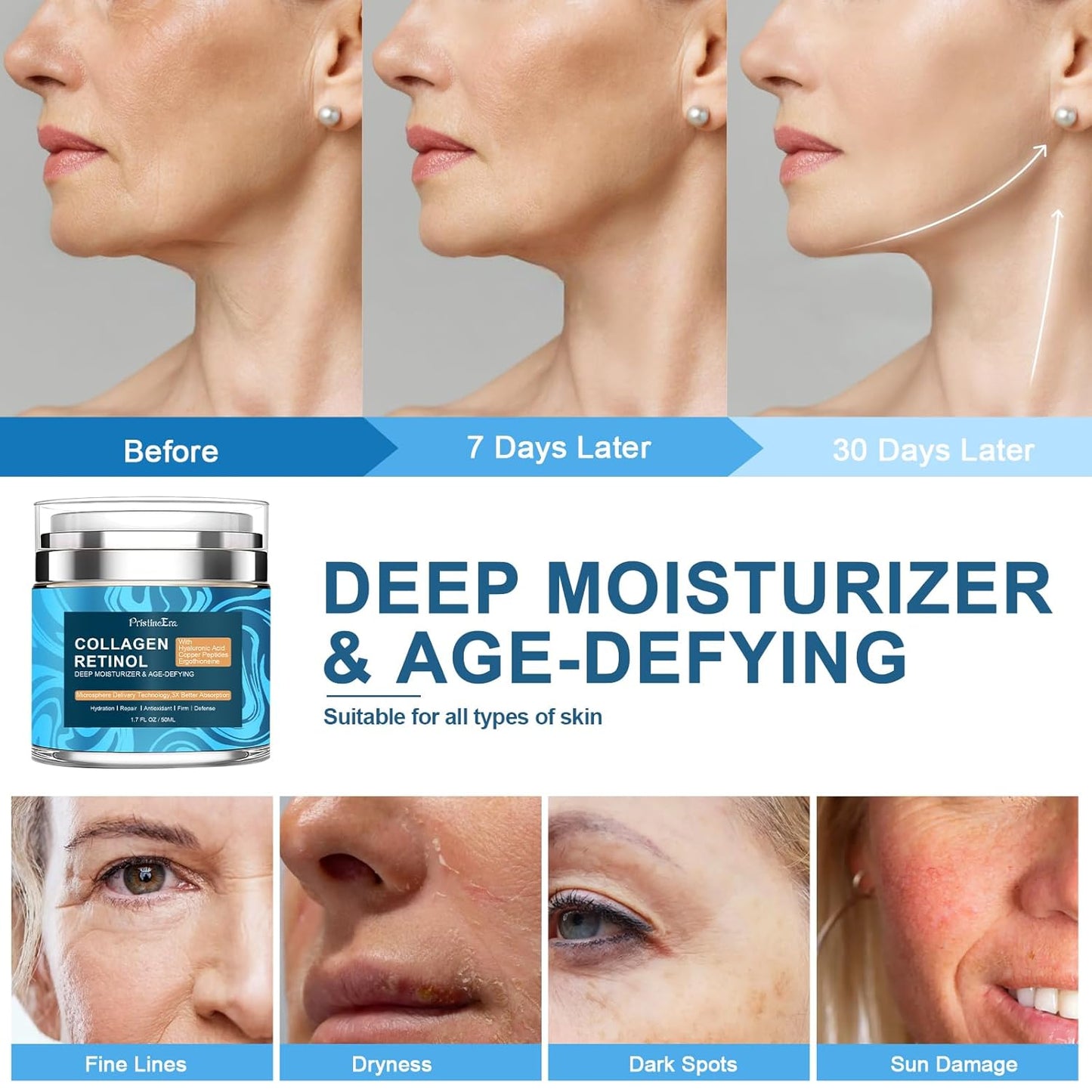 Retinol Collagen Face Moisturizer - Anti-Aging Cream with Hyaluronic Acid | Firming & Hydrating for All Skin Types, 1.7 fl oz