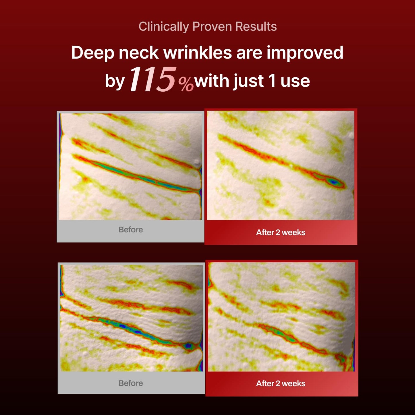 MEDITHERAPY Wrinkle-fit Neck Mask & Wrinkle-fit Face Mask + Facial Roller - Neck Wrinkle Patches, Neck Firming and Tightening Korean Deep Collagen Mask - Mesh Sheet Mask for Lifting Sagging Skin