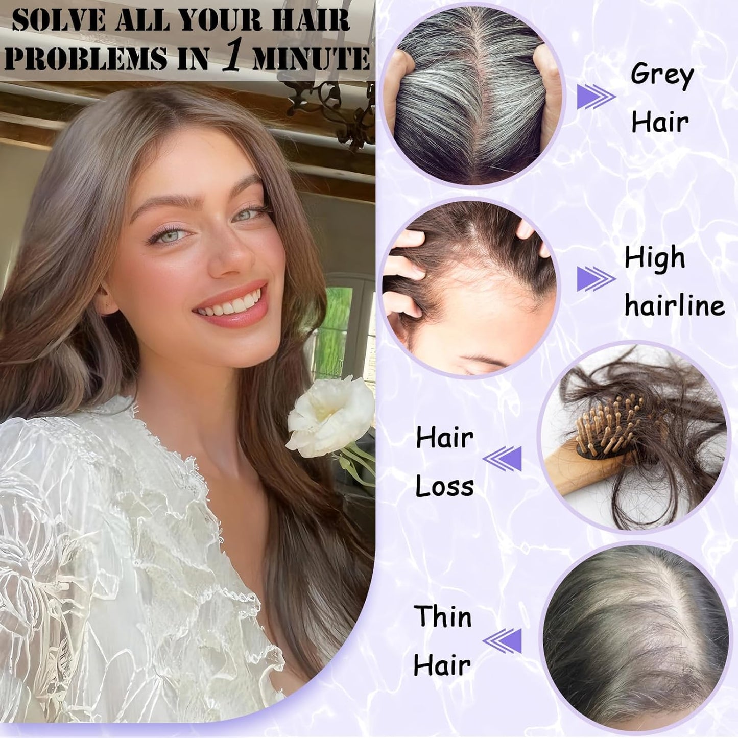 LEDIZE Hair Toppers for Women Real Human Hair, 360° Cover Middle Part Human Hair Toppers for Women with Thinning Realistic Scalp Line Upgrade Basement Toppers Hair Pieces Light Brown, Side Bangs