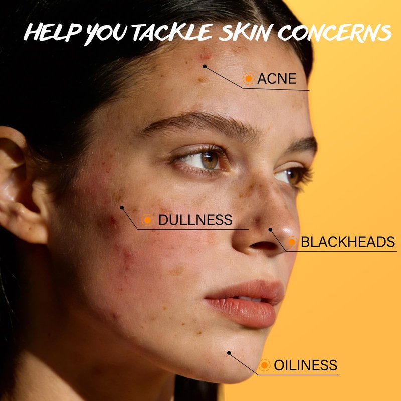 Exfoliating Face Scrub with Turmeric and Vitamin C Face Exfoliator Scrub Powder for Exfoliation Dullness Acne Blackheads Oiliness Exfoliating Face Wash for Women Clean Moisturizes Soothes Amino Acid