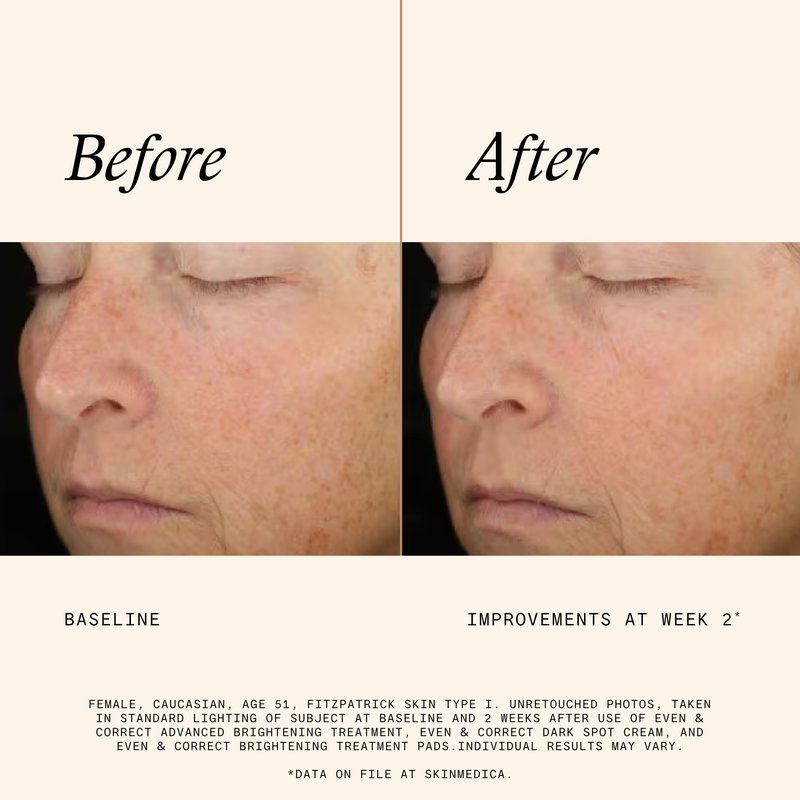 SkinMedica Even & Correct Brightening Treatment Pads For Face Exfoliating, 10% Glycolic Acid Pads That Are Retinol-Free, Alcohol-Free and Hydroquinone-Free, 60 Ct