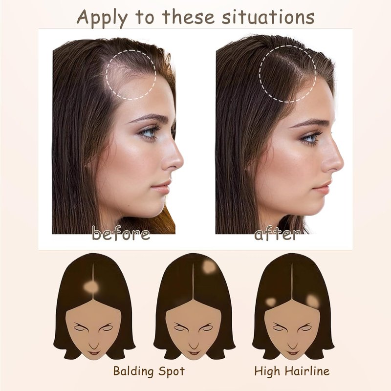 Human Hair Toupee for Hair Loss - Triangle Hair Patch for Men & Women | Dark Brown, 1.6" x 1.6" x 1.6" (2 Pcs)