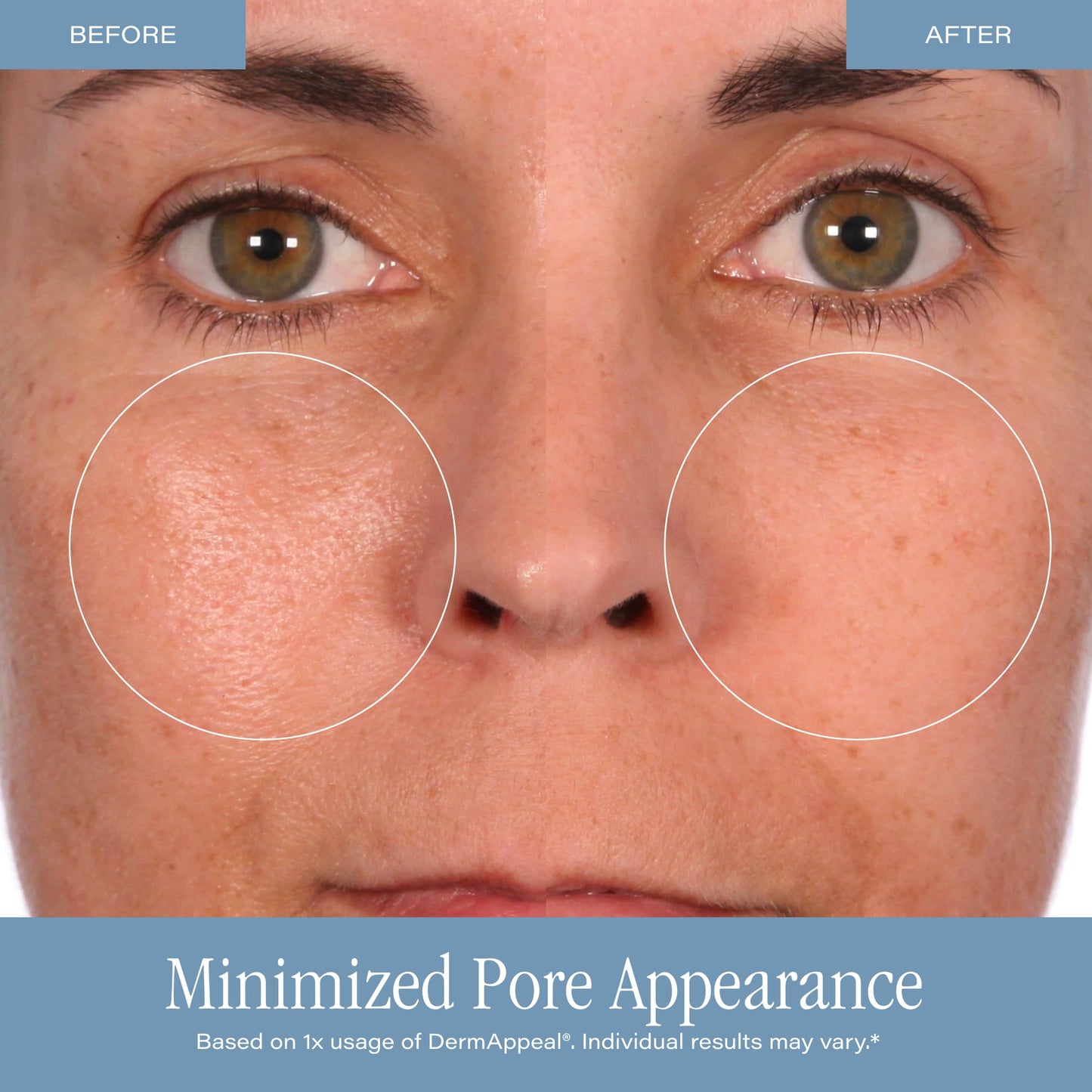 SKINN DermAppeal® Microdermabrasion Treatment - 2 oz