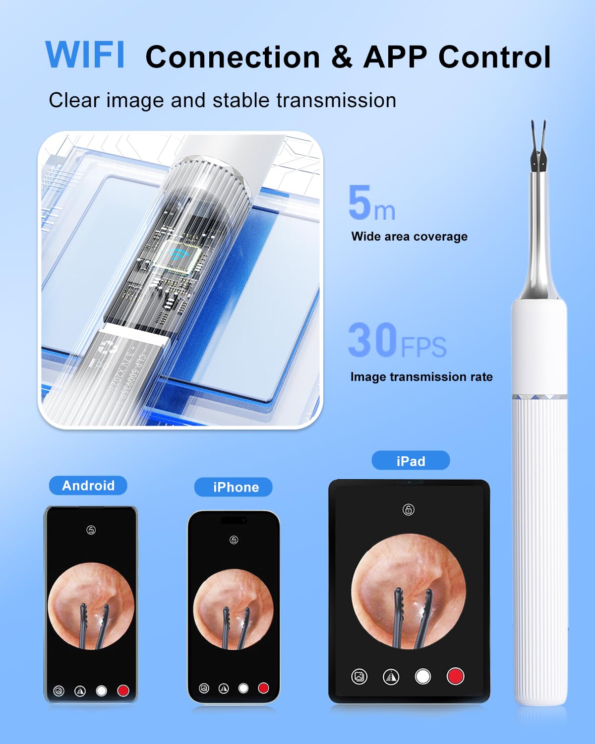 MEKK Smart Ear Wax Removal Kit S5-10MP HD Visual Ear Cleaner with Precision Tweezers, 12 Tools & Travel Case - Wireless Otoscope for iOS/Android (White-S5)