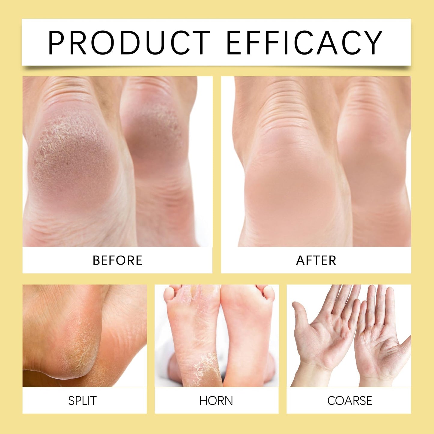Crack Feet Prevention Stick, Heel Cream For Dry Cracked Feet, Foot Care Cream Moisturizing Foot Balm, Remove Dead Skin And Softening Dry Skin (Pink+Blue)