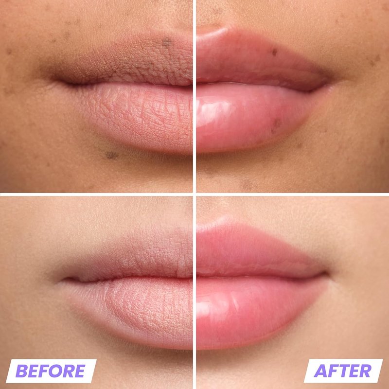 Wonderskin Lip Plumper Gloss - Hydrating Plumping Gloss for Fuller Lips | Non-Sticky High-Shine Finish