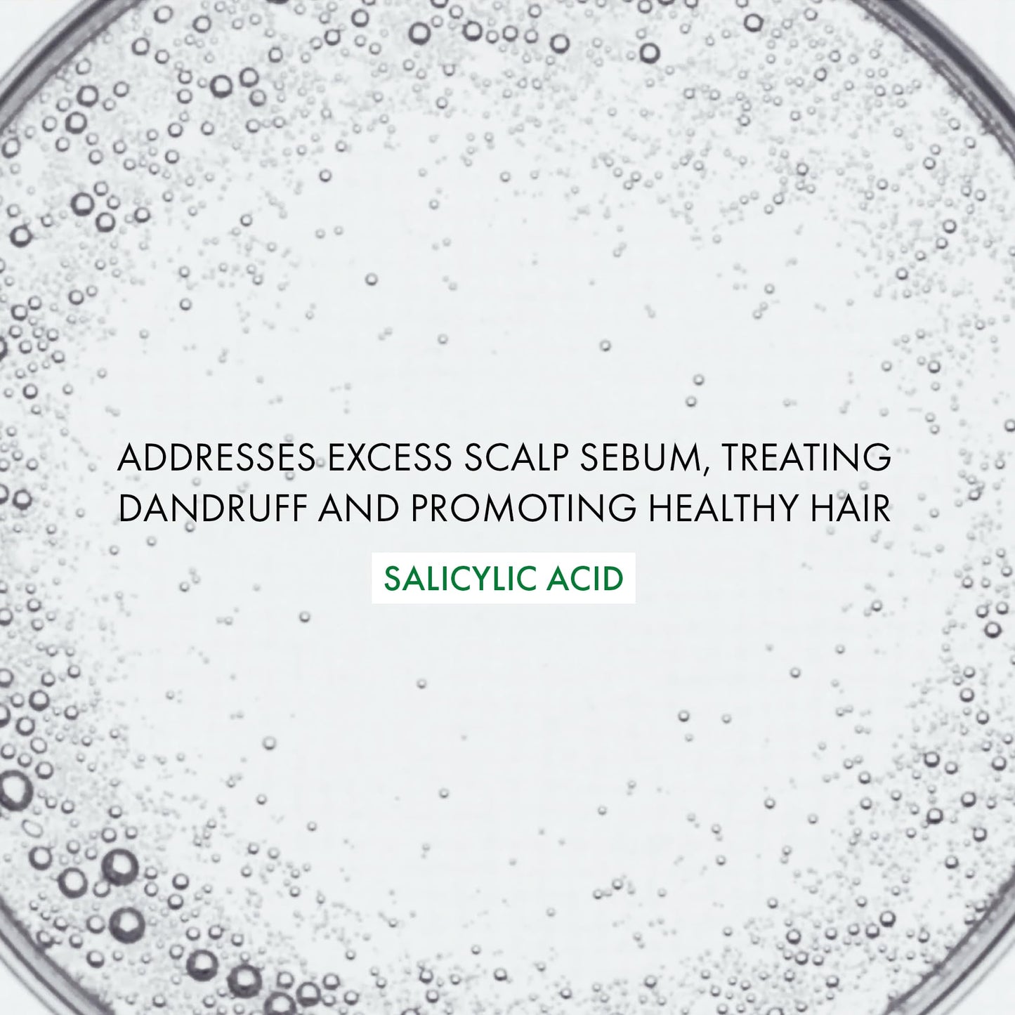 Vichy Dercos Salicylic Acid Anti-Dandruff Treatment, Scalp Treatment Targets Dandruff Symptoms & Leaves Head Feeling Hydrated & Soothed, Serum Provides Flake & Itch Relief, 3 Fl. Oz.
