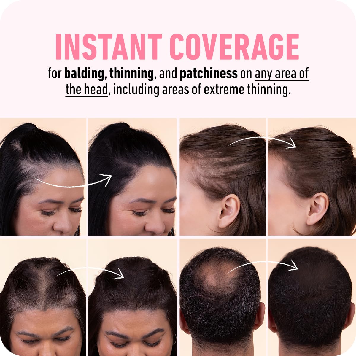 BOLDIFY Hairline Powder (LARGE, 10g) - Water-Resistant Root Touch Up Hair Color for Gray Coverage - 24-Hour Stain-Proof, Mess-Free Hair Powder for Thinning Hair - Black