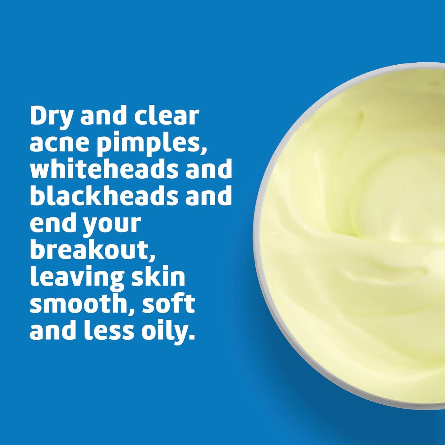 De La Cruz 10% Sulfur Ointment | Cystic Acne Treatment for Face & Body - 2.6 oz Daily Spot Treatment Mask