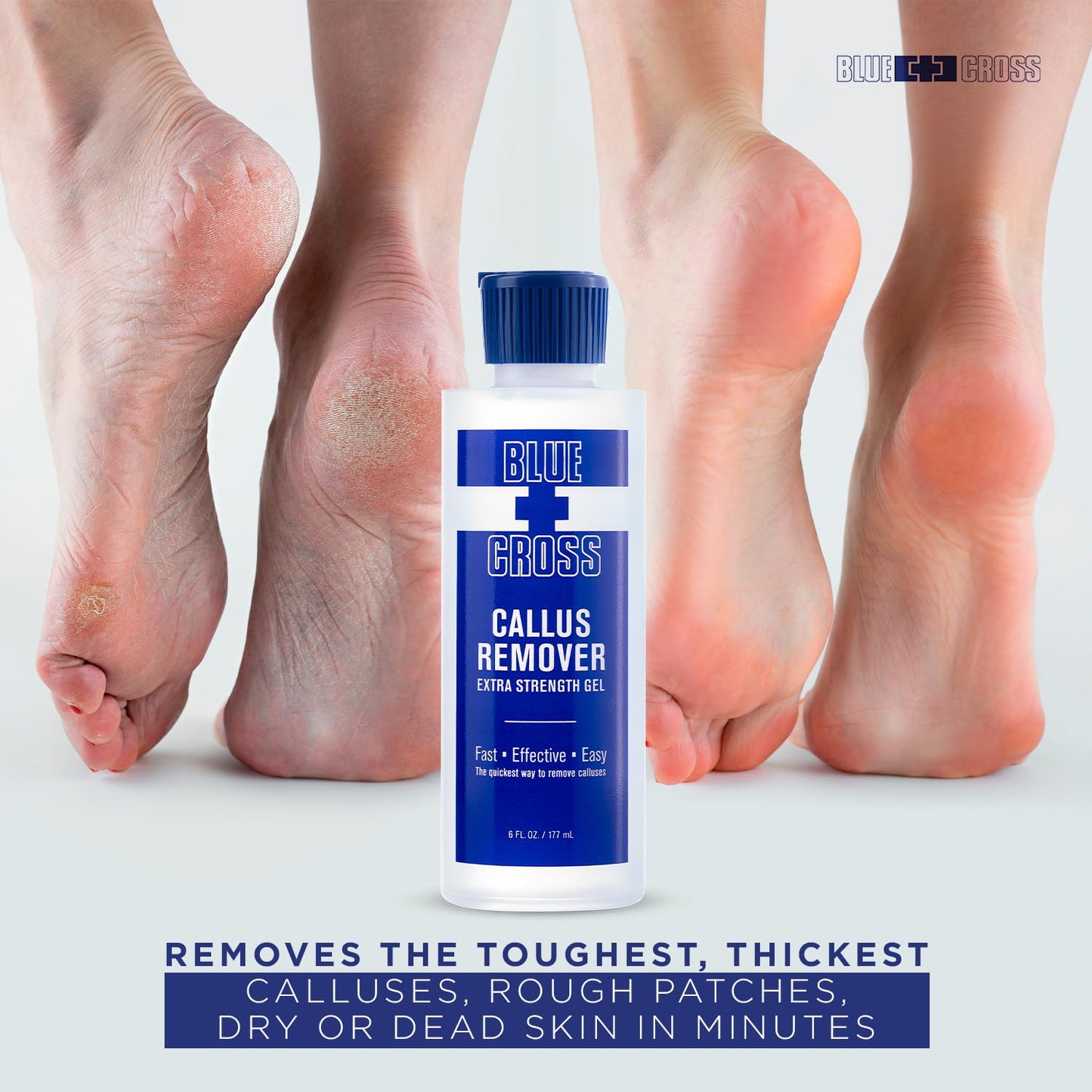 Blue Cross Callus Remover Gel for Feet or Heel, Extra Strength Professional Nail Care, File, Shaver, Scrubber & Pumice Stone Alternative for At Home Manicure/Pedicure Results, 6oz