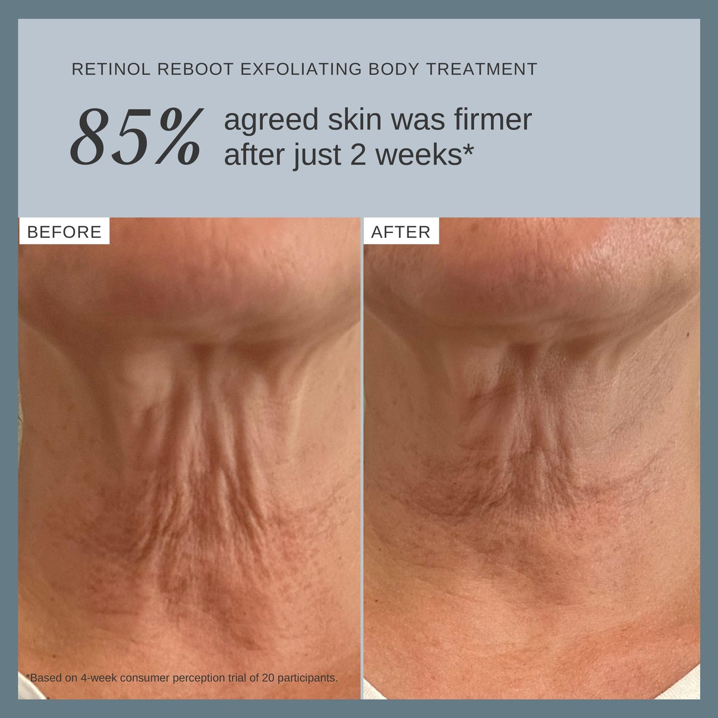 Alpha-H Retinol Reboot Exfoliating Body Treatment 120ml - Firm, Smooth & Brighten Body Skin - Reduces the Appearance of Fine Lines, Redness & Uneven Tone - Neck, Décolletage, Arms & Legs