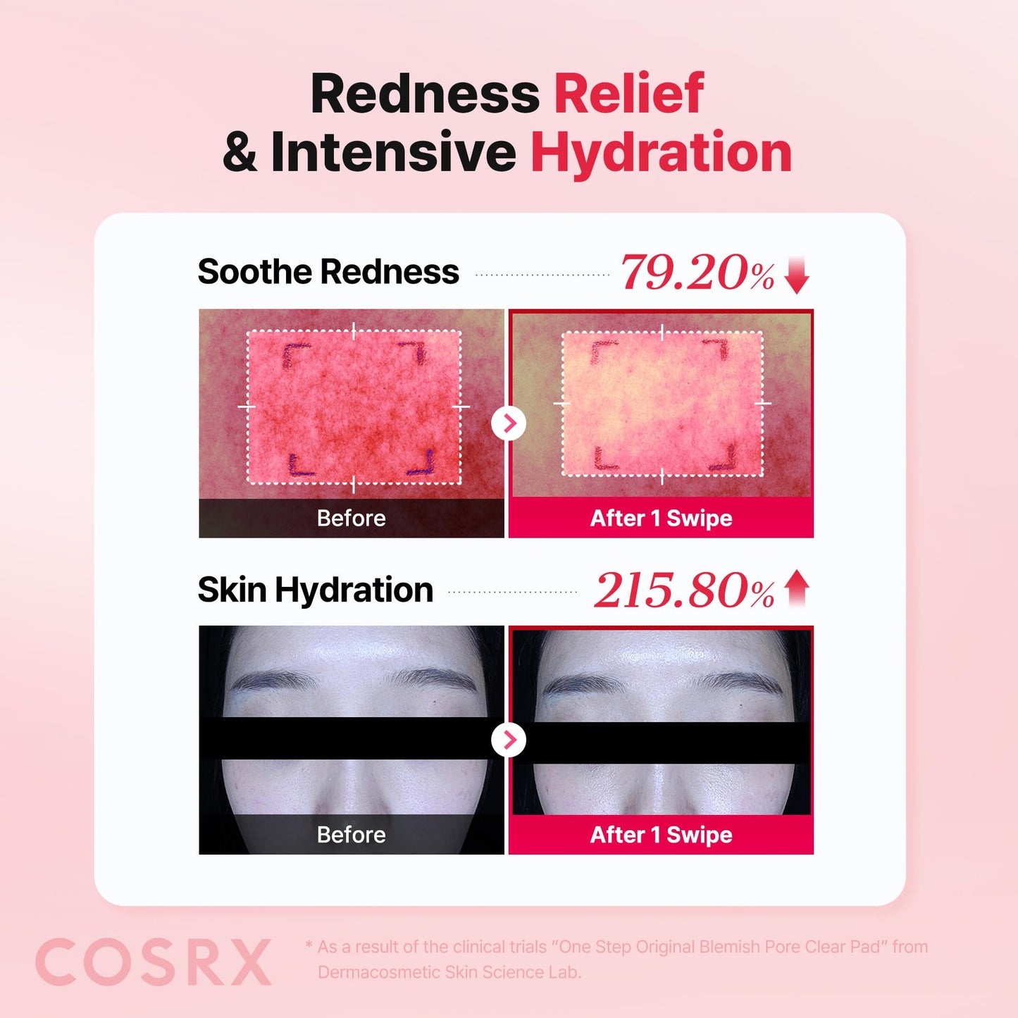 COSRX Onestep Original Pad Variation