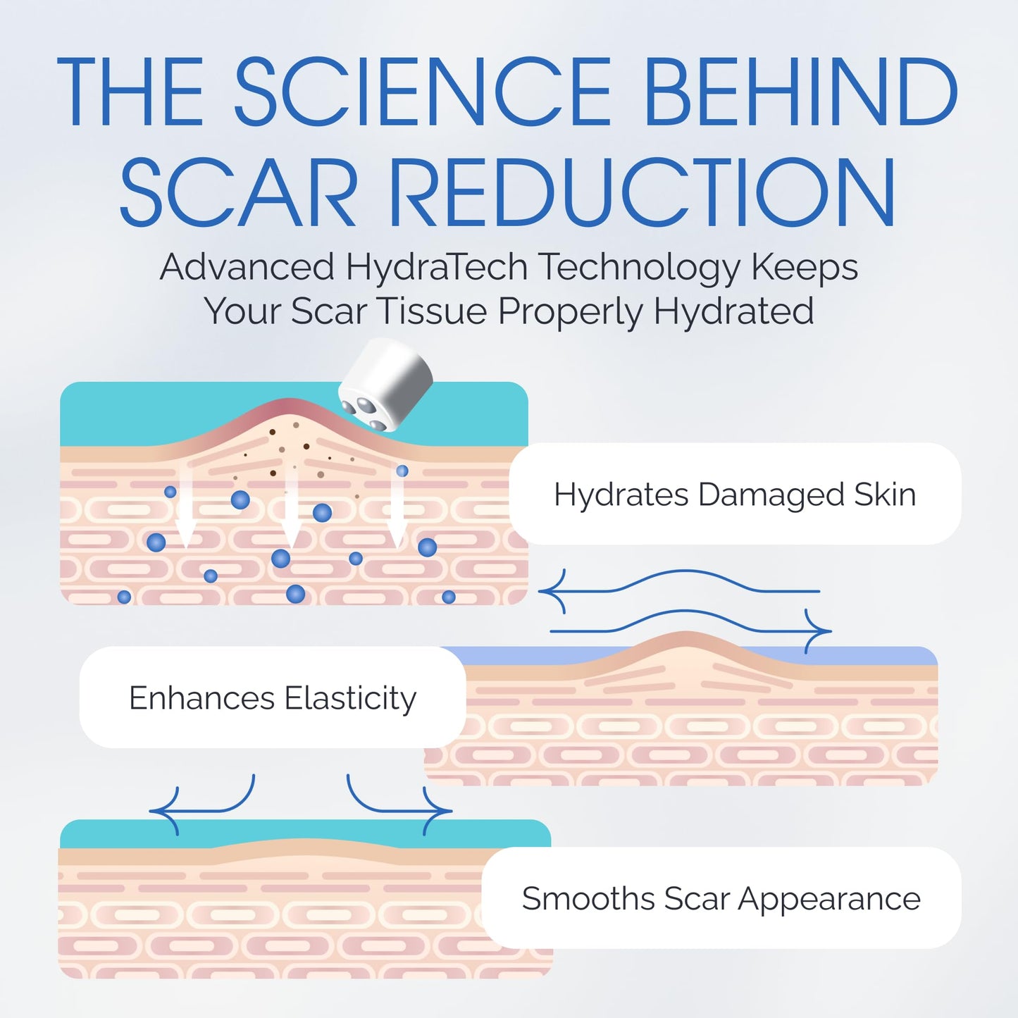 Silicone Scar Gel with Scar-Smoothing Tri-Roller Tip – Designed for Scar Massage – Medical-Grade Silicone for Surgical, C-Section & Acne Scars – Fragrance-Free & Hypoallergenic