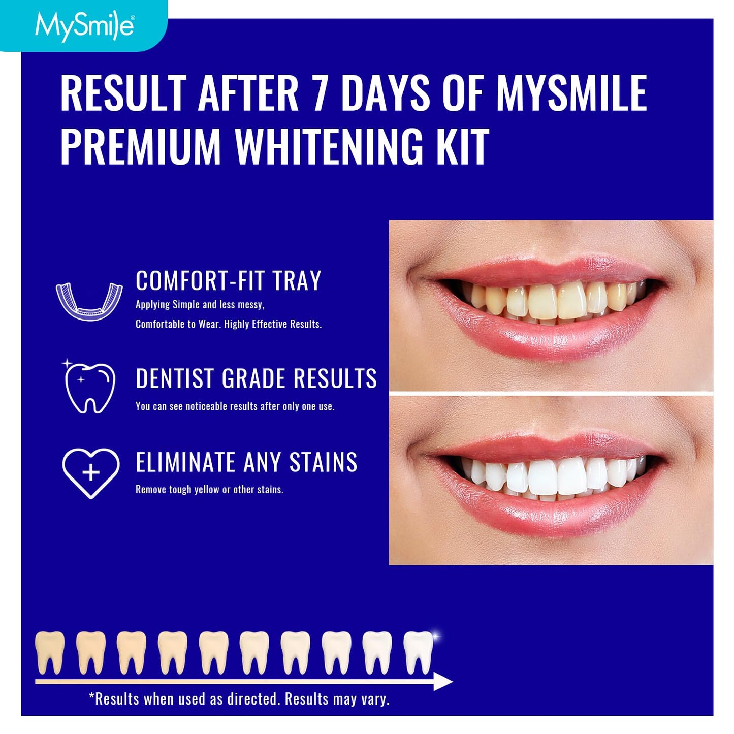 MySmile 7 Treatments Prefilled Teeth Whitening Trays Kit with 12% Hydrogen Peroxide Whiter Gel for Sensitive Tooth, Fast-Result Vegan Teeth Whitener U-Wraps Tooth Stain Remover, Mint Flavor