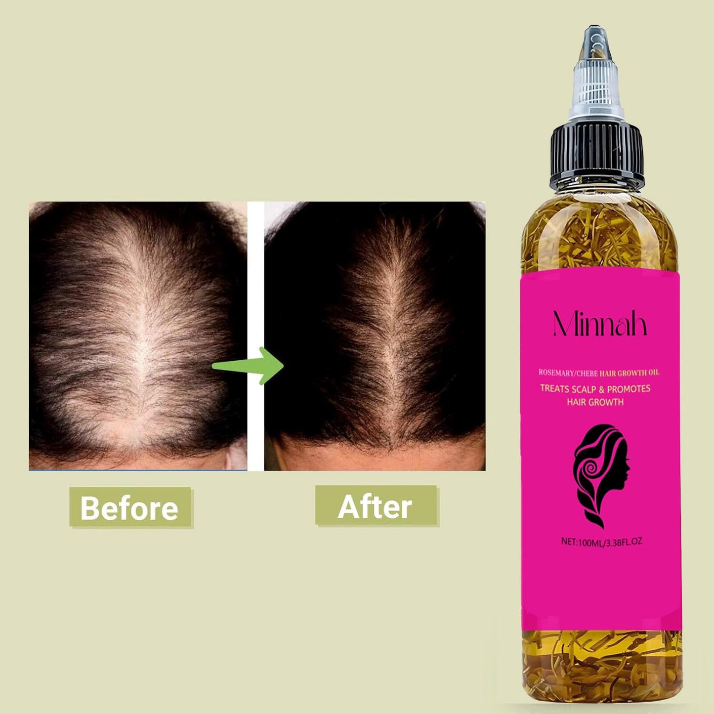 Minnah Batana Oil for Hair Growth - 4-in-1 Nourishing Formula with Rosemary & Pumpkin Seed | 1 oz