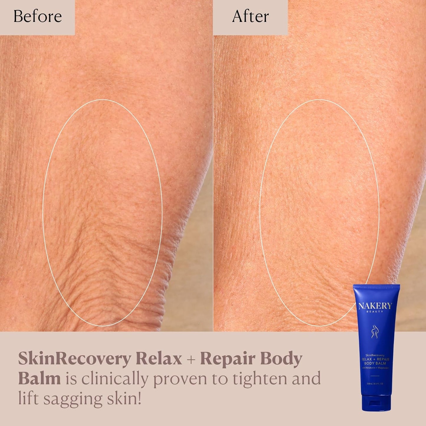 **SkinRecovery Body Balm - Magnesium Melatonin Sleep Lotion with Retinol & SepiLift | Firming Cream for Crepey Skin, 250mL**
