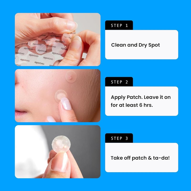 AVARELLE Pimple Patches - Hydrocolloid Acne Treatment with Tea Tree Oil | 80 Count, Vegan & Cruelty-Free
