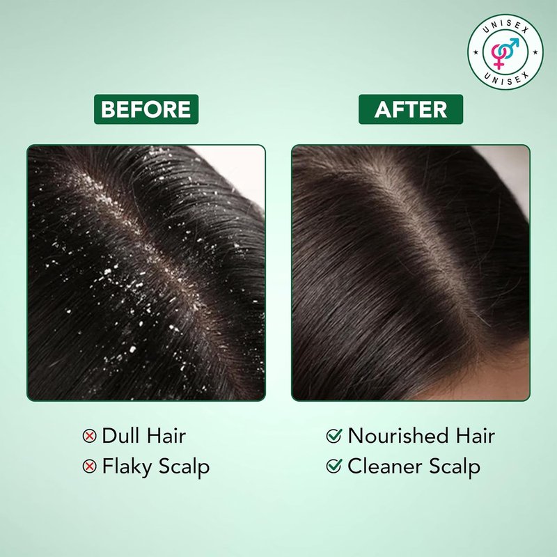 Tea Tree Shampoo and Conditioner Set - 100% Pure Tea Tree Oil for Itchy, Dry Scalp | 16 Fl Oz Each