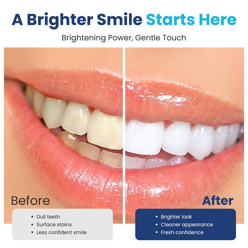 Pro White Advanced Whitening Strips - Teeth Strips with Fresh Mint Flavor- Whitening Strips With 28 Applications for Easy Daily Use - Refresh Your Smile with Fast Acting Teeth Whitening Strips- 2 pack