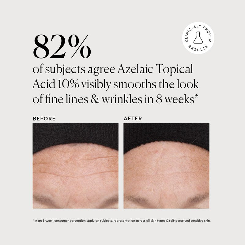 Naturium Azelaic Topical Acid 10% Jumbo, Face & Skin Care Beauty Treatment with Niacinamide & Vitamin C, 2 oz